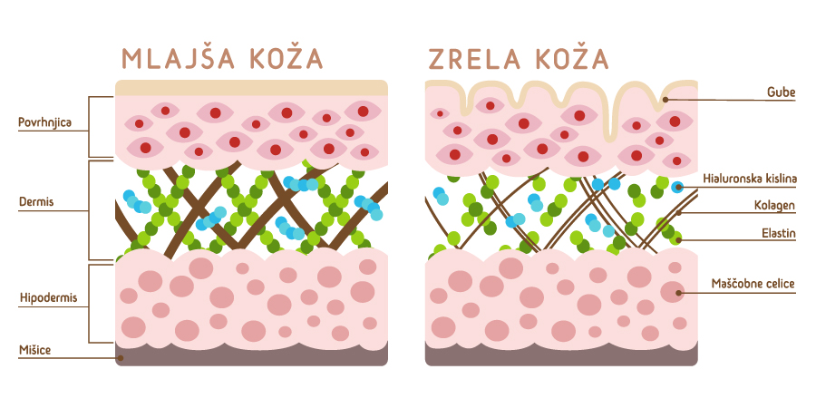 koza